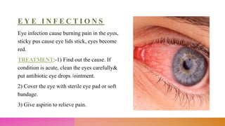 E Y E I N F E C T I O N S
Eye infection cause burning pain in the eyes,
sticky pus cause eye lids stick, eyes become
red.
TREATMENT:-1) Find out the cause. If
condition is acute, clean the eyes carefully&
put antibiotic eye drops /ointment.
2) Cover the eye with sterile eye pad or soft
bandage.
3) Give aspirin to relieve pain.
 