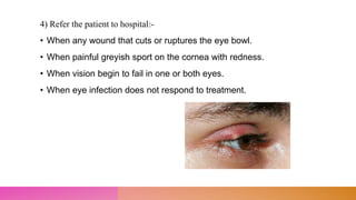 4) Refer the patient to hospital:-
• When any wound that cuts or ruptures the eye bowl.
• When painful greyish sport on the cornea with redness.
• When vision begin to fail in one or both eyes.
• When eye infection does not respond to treatment.
 