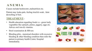 A N E M I A
Causes include hookworm ,malnutrition etc.
Patient may looks pale, feeling tired & weak , faint
&swelling of feet.
TREATMENT:-
• Health education regarding foods i.e - green leafy
vegetables like spinach, pulses, jaggery, eggs etc.
Advice oral iron & vitamins.
• Stool examination & HB test.
• Bleeding piles , menstrual disorders with excessive
bleeding & other bleeding condition then refer the
patient to primary health Centre /hospital
immediately.
 