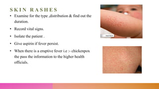 S K I N R A S H E S
• Examine for the type ,distribution & find out the
duration.
• Record vital signs.
• Isolate the patient .
• Give aspirin if fever persist.
• When there is a eruptive fever i.e :- chickenpox
the pass the information to the higher health
officials.
 