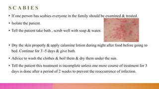 S C A B I E S
• If one person has scabies everyone in the family should be examined & treated.
• Isolate the patient.
• Tell the patient take bath , scrub well with soap & water.
• Dry the skin properly & apply calamine lotion during night after food before going to
bed. Continue for 3 -5 days & give bath.
• Advice to wash the clothes & boil them & dry them under the sun.
• Tell the patient this treatment is incomplete unless one more course of treatment for 3
days is done after a period of 2 weeks to prevent the reoccurrence of infection.
 
