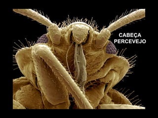 CABEÇA  PERCEVEJO 