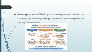 Rpd Computer Comprehensive Overview of Minor Connectors in Removable Partial ...