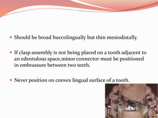  Should be broad buccolingually but thin mesiodistally.
 If clasp assembly is not being placed on a tooth adjacent to
an edentulous space,minor connector must be positioned
in embrassure between two teeth.
 Never position on convex lingual surface of a tooth.
 