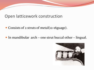Open latticework construction
 Consists of 2 struts of metal(12-16guage).
 In mandibular arch – one strut buccal other – lingual.
 