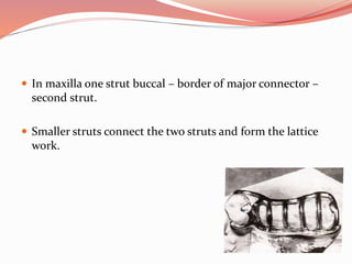  In maxilla one strut buccal – border of major connector –
second strut.
 Smaller struts connect the two struts and form the lattice
work.
 