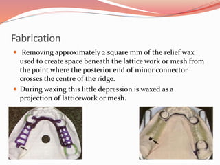 Fabrication
 Removing approximately 2 square mm of the relief wax
used to create space beneath the lattice work or mesh from
the point where the posterior end of minor connector
crosses the centre of the ridge.
 During waxing this little depression is waxed as a
projection of latticework or mesh.
 