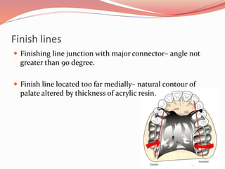 Finish lines
 Finishing line junction with major connector– angle not
greater than 90 degree.
 Finish line located too far medially– natural contour of
palate altered by thickness of acrylic resin.
 