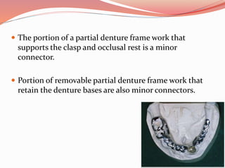  The portion of a partial denture frame work that
supports the clasp and occlusal rest is a minor
connector.
 Portion of removable partial denture frame work that
retain the denture bases are also minor connectors.
 
