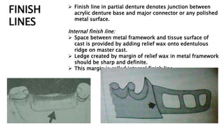 Metal Rpd Finish Line Minor connectors | PPTX