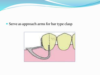  Serve as approach arms for bar type clasp
 