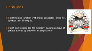 Finish lines
 Finishing line junction with major connector– angle not
greater than 90 degree.
 Finish line located too far medially– natural contour of
palate altered by thickness of acrylic resin.
 
