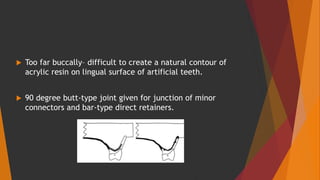  Too far buccally– difficult to create a natural contour of
acrylic resin on lingual surface of artificial teeth.
 90 degree butt-type joint given for junction of minor
connectors and bar-type direct retainers.
 