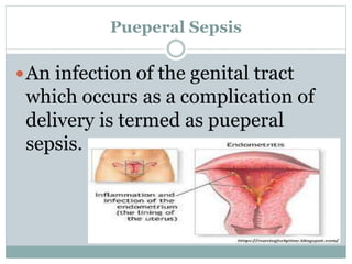 Pueperal Sepsis
An infection of the genital tract
which occurs as a complication of
delivery is termed as pueperal
sepsis.
 
