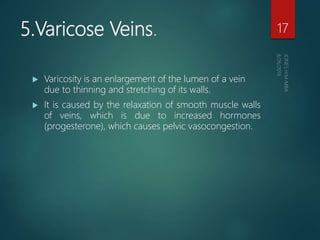 5.Varicose Veins.
 Varicosity is an enlargement of the lumen of a vein
due to thinning and stretching of its walls.
 It is caused by the relaxation of smooth muscle walls
of veins, which is due to increased hormones
(progesterone), which causes pelvic vasocongestion.
17
 