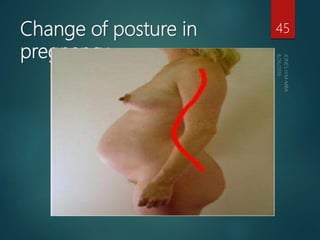 Change of posture in
pregnancy
45
 