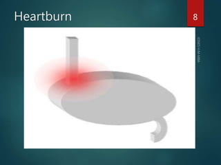 Heartburn 8
 