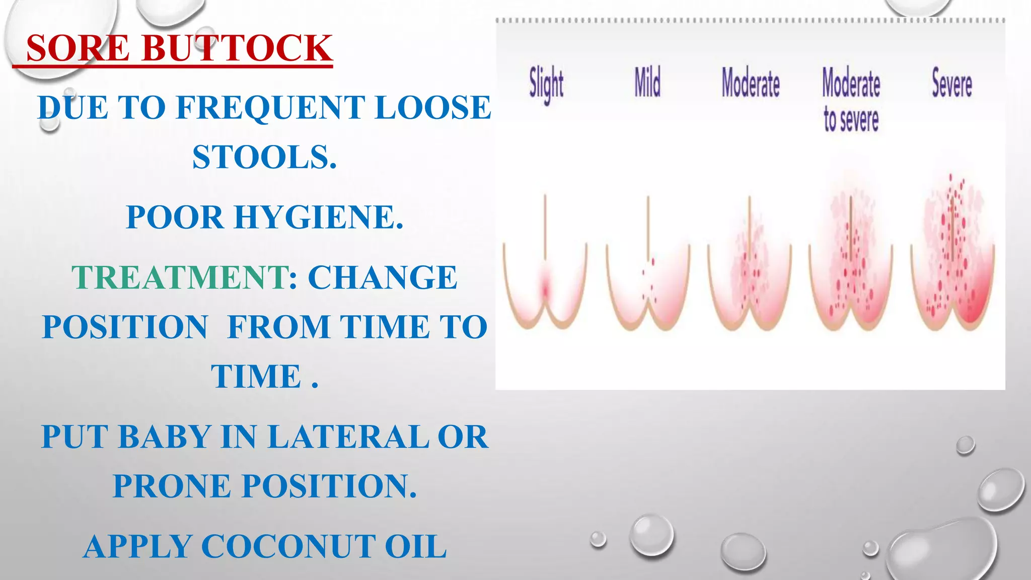 Minor disorders of newborn | PPTX