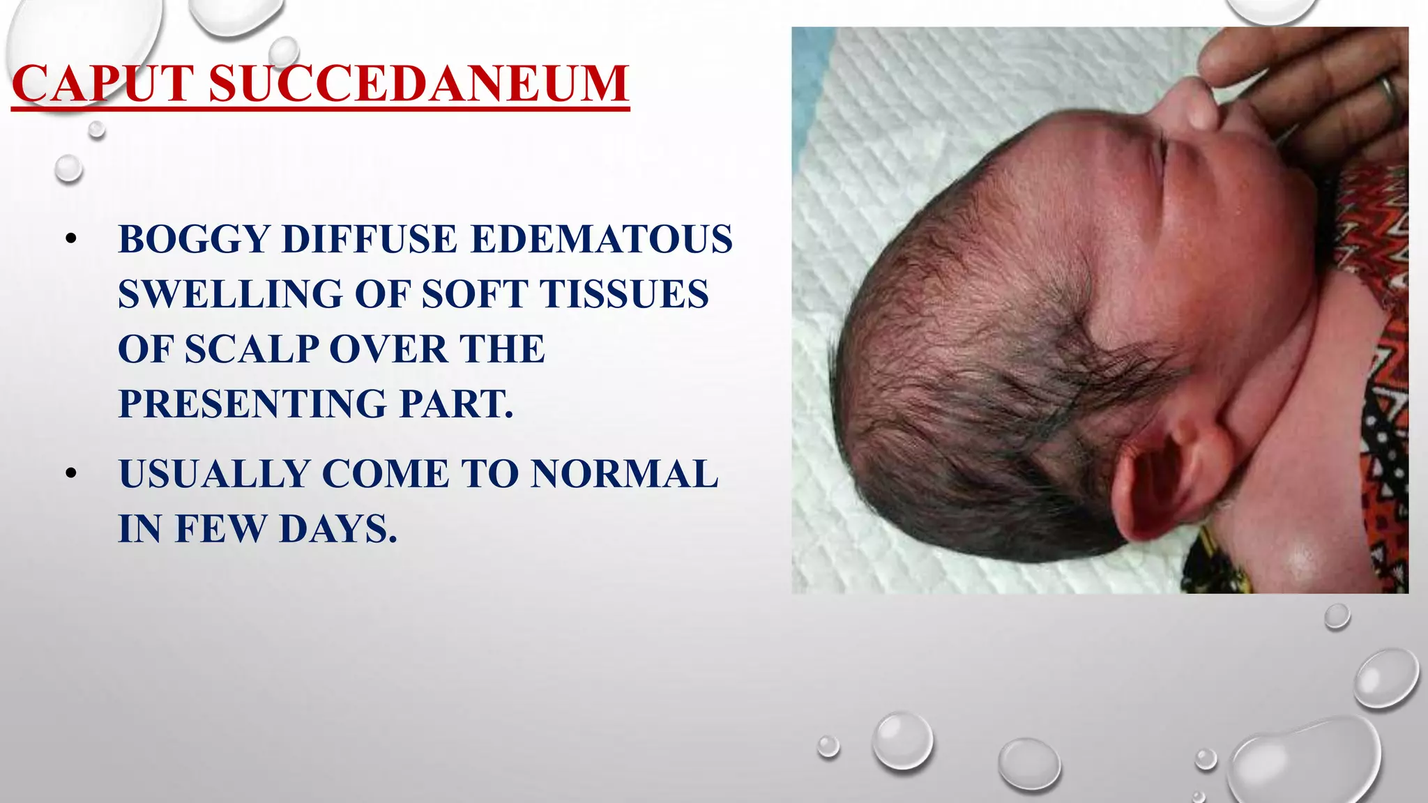 Minor disorders of newborn | PPTX