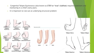 Comprehensive Overview of Minor Neonatal Complications and Their ...
