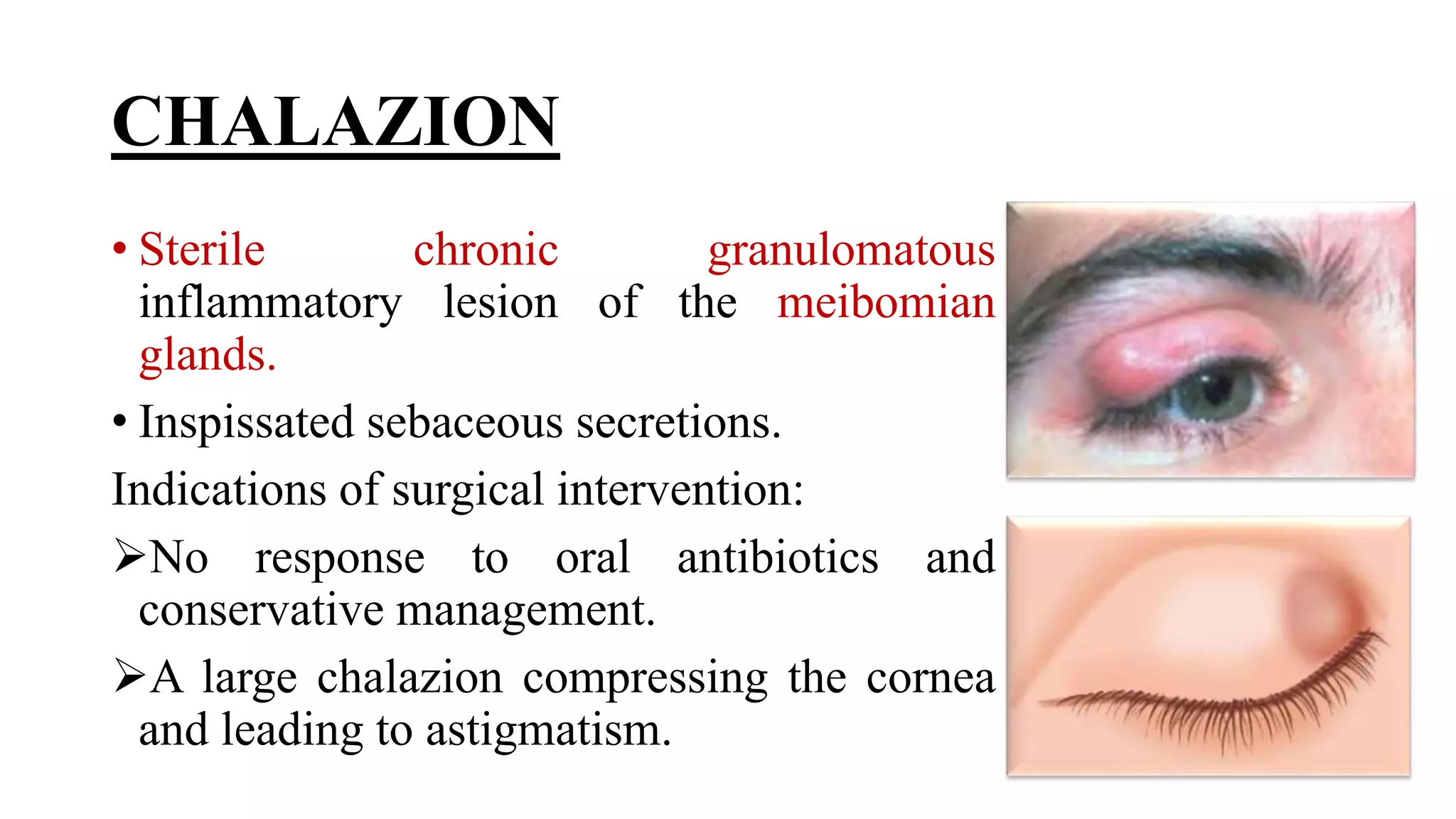 Minor ophthalmic procedures and instruments