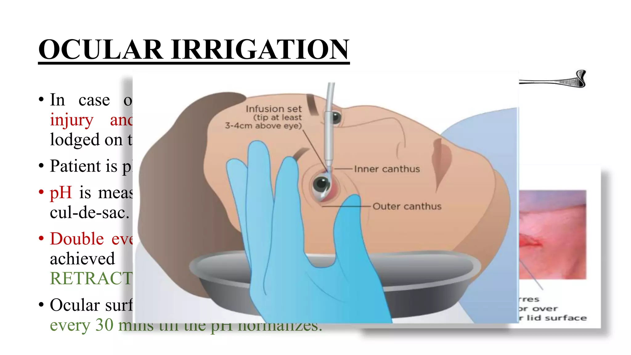 Minor ophthalmic procedures and instruments