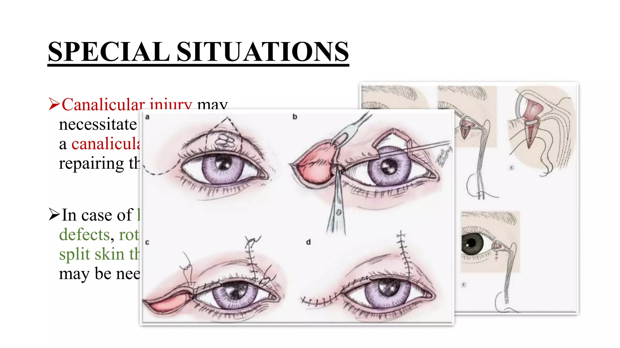 Minor ophthalmic procedures and instruments