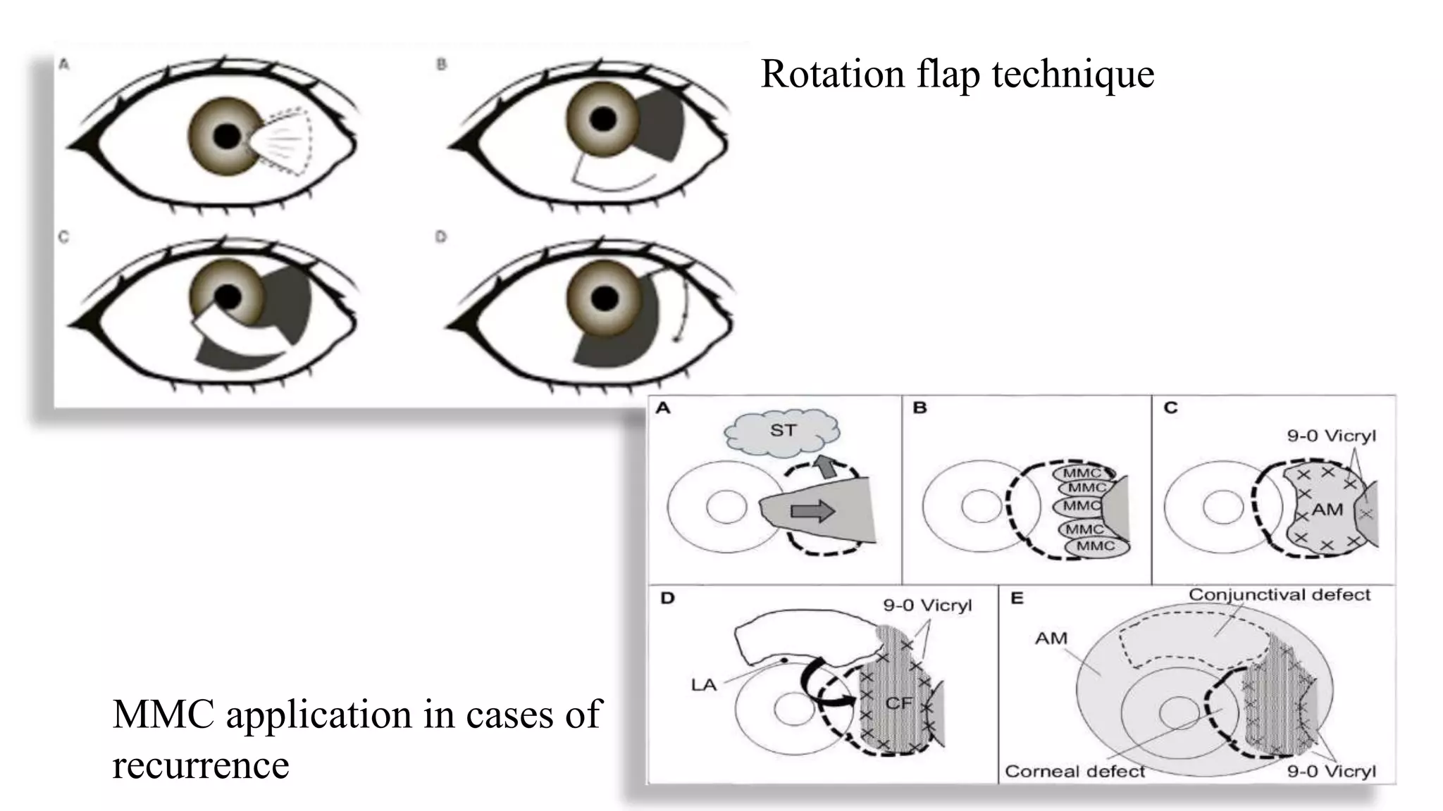 Minor ophthalmic procedures and instruments