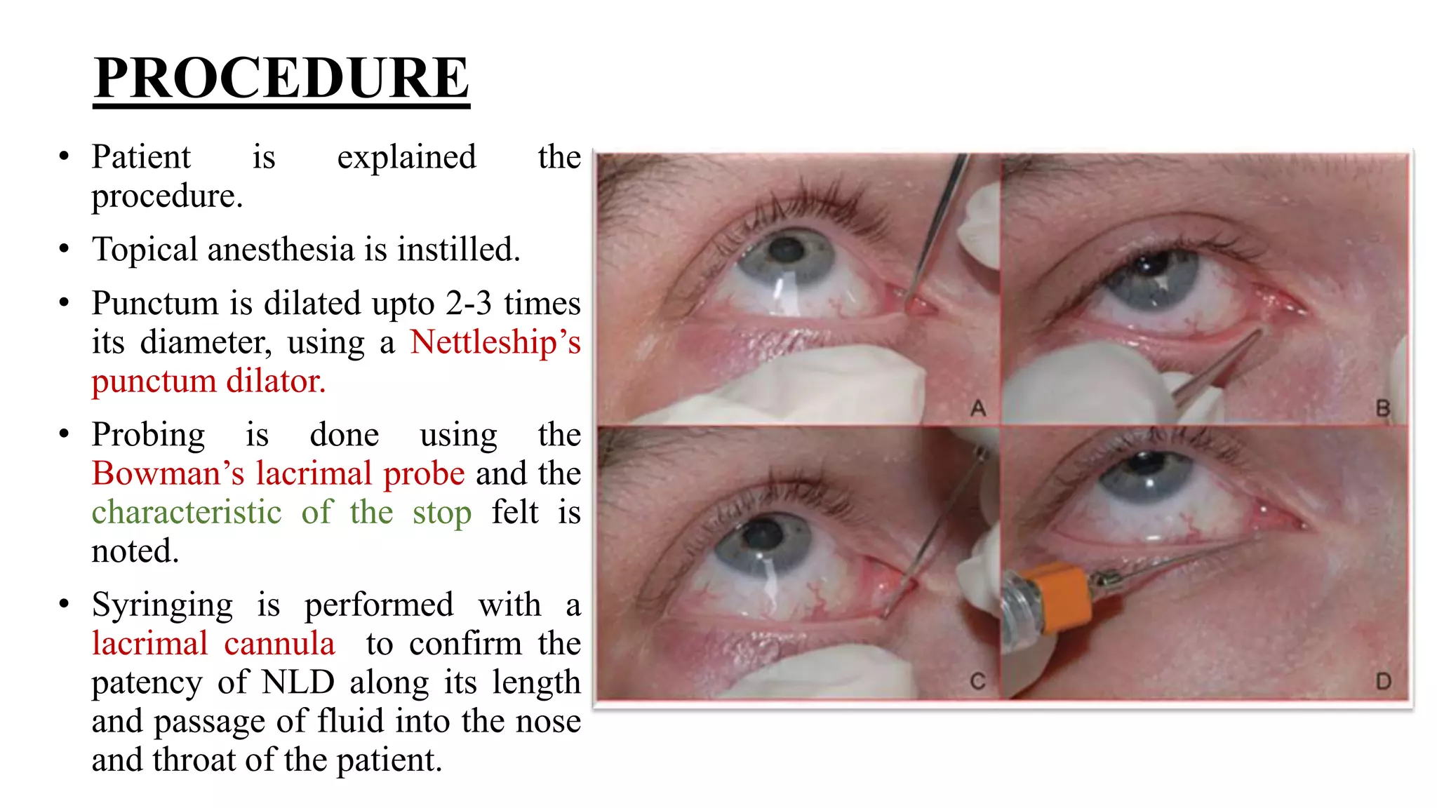 Minor ophthalmic procedures and instruments