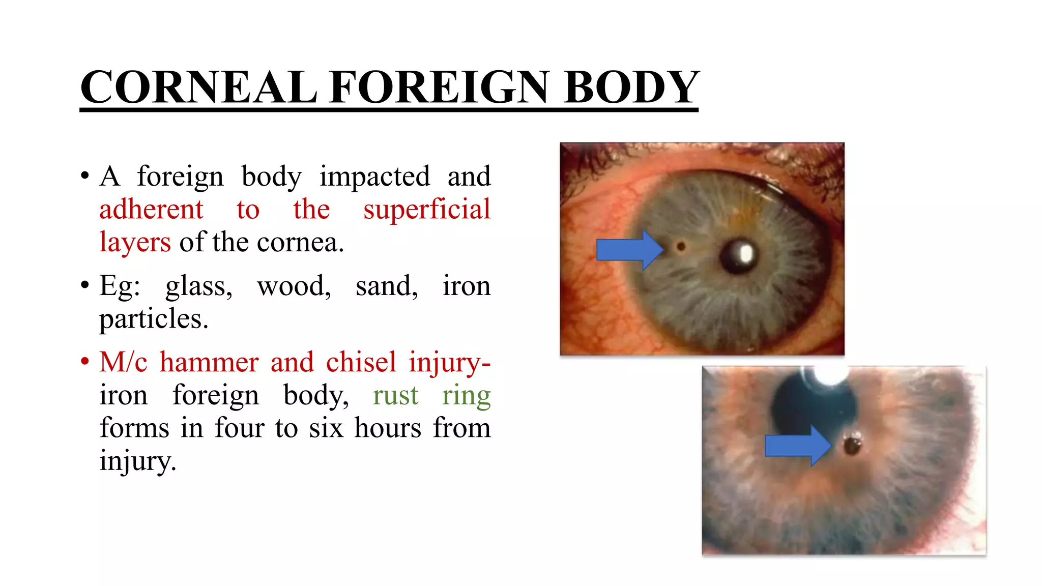 Minor ophthalmic procedures and instruments
