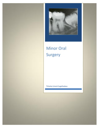 Minor Oral
Surgery
Thilanka Umesh Sugathadasa
 
