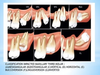 minor oral surgical procedures final.pptx