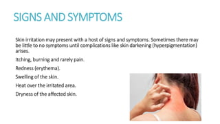 SIGNS AND SYMPTOMS
Skin irritation may present with a host of signs and symptoms. Sometimes there may
be little to no symptoms until complications like skin darkening (hyperpigmentation)
arises.
Itching, burning and rarely pain.
Redness (erythema).
Swelling of the skin.
Heat over the irritated area.
Dryness of the affected skin.
 