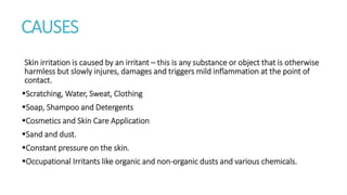 CAUSES
Skin irritation is caused by an irritant – this is any substance or object that is otherwise
harmless but slowly injures, damages and triggers mild inflammation at the point of
contact.
Scratching, Water, Sweat, Clothing
Soap, Shampoo and Detergents
Cosmetics and Skin Care Application
Sand and dust.
Constant pressure on the skin.
Occupational Irritants like organic and non-organic dusts and various chemicals.
 