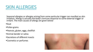 SKIN ALLERGIES
Seasonal allergies or allergies arising from some particular trigger can manifest as skin
irritation. Allergy is actually the body’s immune response to some external trigger or
irritant. The main causes of allergy are given below-
Dust
Pollen grains
Peanuts, gluten, eggs, shellfish
Animal dander or saliva
Secretions of different insects
Cosmetics or perfumes
 