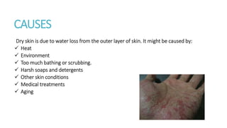 CAUSES
Dry skin is due to water loss from the outer layer of skin. It might be caused by:
 Heat
 Environment
 Too much bathing or scrubbing.
 Harsh soaps and detergents
 Other skin conditions
 Medical treatments
 Aging
 