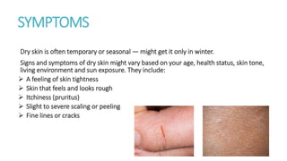 SYMPTOMS
Dry skin is often temporary or seasonal — might get it only in winter.
Signs and symptoms of dry skin might vary based on your age, health status, skin tone,
living environment and sun exposure. They include:
 A feeling of skin tightness
 Skin that feels and looks rough
 Itchiness (pruritus)
 Slight to severe scaling or peeling
 Fine lines or cracks
 