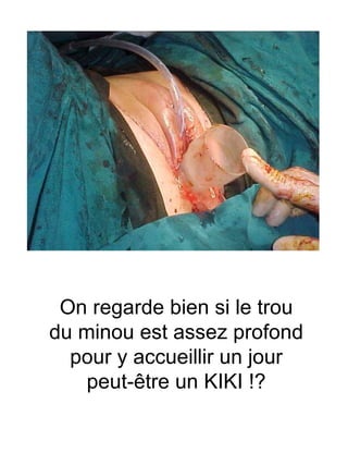 On regarde bien si le trou du minou est assez profond pour y accueillir un jour peut-être un KIKI !? 