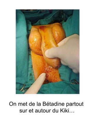 On met de la Bétadine partout  sur et autour du Kiki… 