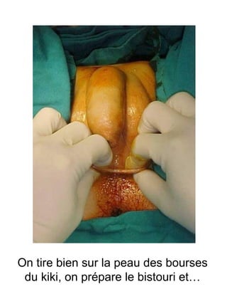 On tire bien sur la peau des bourses du kiki, on prépare le bistouri et… 