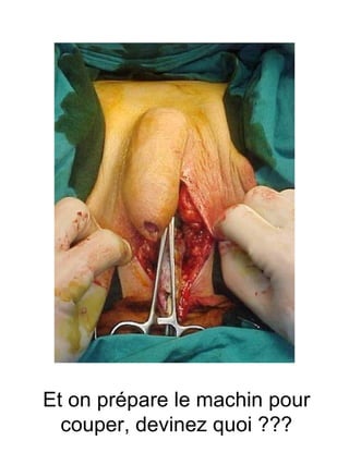 Et on prépare le machin pour couper, devinez quoi ??? 