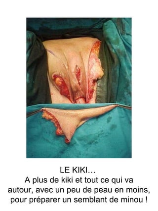 LE KIKI…  A plus de kiki et tout ce qui va autour, avec un peu de peau en moins,  pour préparer un semblant de minou ! 