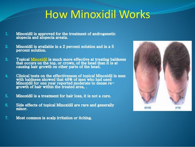 what happens if a woman uses minoxidil