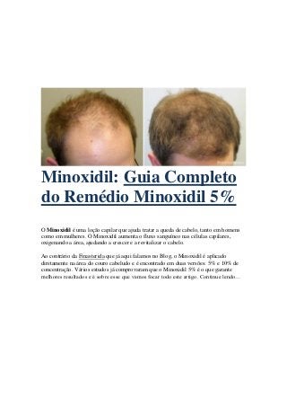 Minoxidil: Guia Completo
do Remédio Minoxidil 5%
O Minoxidil é uma loção capilar que ajuda tratar a queda de cabelo, tanto em homens
como em mulheres. O Minoxidil aumenta o fluxo sanguíneo nas células capilares,
oxigenando a área, ajudando a crescer e a revitalizar o cabelo.
Ao contrário da Finasterida que já aqui falamos no Blog, o Minoxidil é aplicado
diretamente na área do couro cabeludo e é encontrado em duas versões: 5% e 10% de
concentração. Vários estudos já comprovaram que o Minoxidil 5% é o que garante
melhores resultados e é sobre esse que vamos focar todo este artigo. Continue lendo…
 