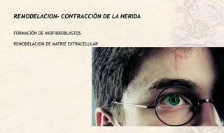 REMODELACION- CONTRACCIÓN DE LA HERIDA
FORMACIÓN DE MIOFIBROBLASTOS
REMODELACION DE MATRIZ EXTRACELULAR
 