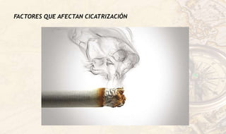 FACTORES QUE AFECTAN CICATRIZACIÓN
 