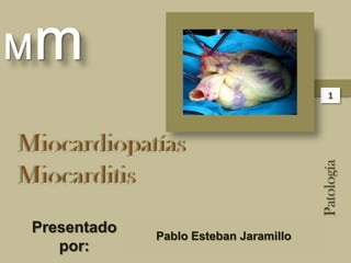 Mm 1 Patología Miocardiopatías Miocarditis 