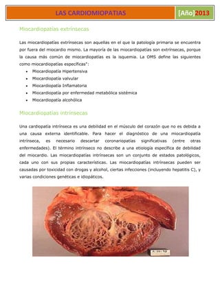 Miocardiopatia Slide 2