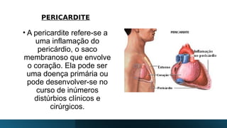 PERICARDITE
• A pericardite refere-se a
uma inflamação do
pericárdio, o saco
membranoso que envolve
o coração. Ela pode ser
uma doença primária ou
pode desenvolver-se no
curso de inúmeros
distúrbios clínicos e
cirúrgicos.
 