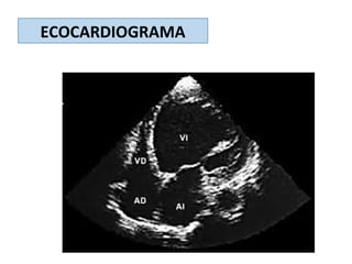 ECOCARDIOGRAMA
 